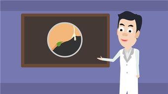 胆囊触诊视频,视频教学带你轻松掌握